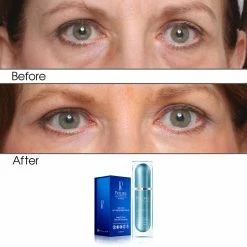 Best deal 👍 Predire Paris Rapid Renewal Eye Care Anti Aging Night Serum ✔️ -Predire Paris Sales 03ae910b112f4b0f9d7c7310bdc170f4 1080x